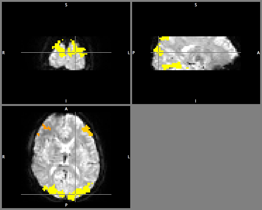 cluster mask examples