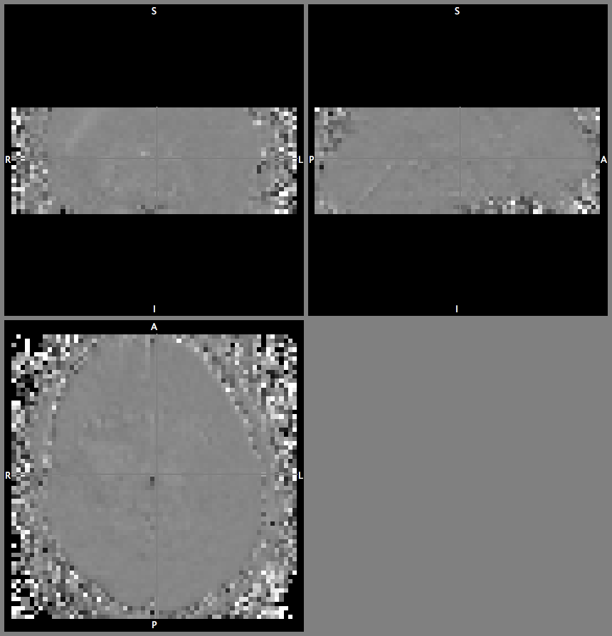 example of percent signal timecourse