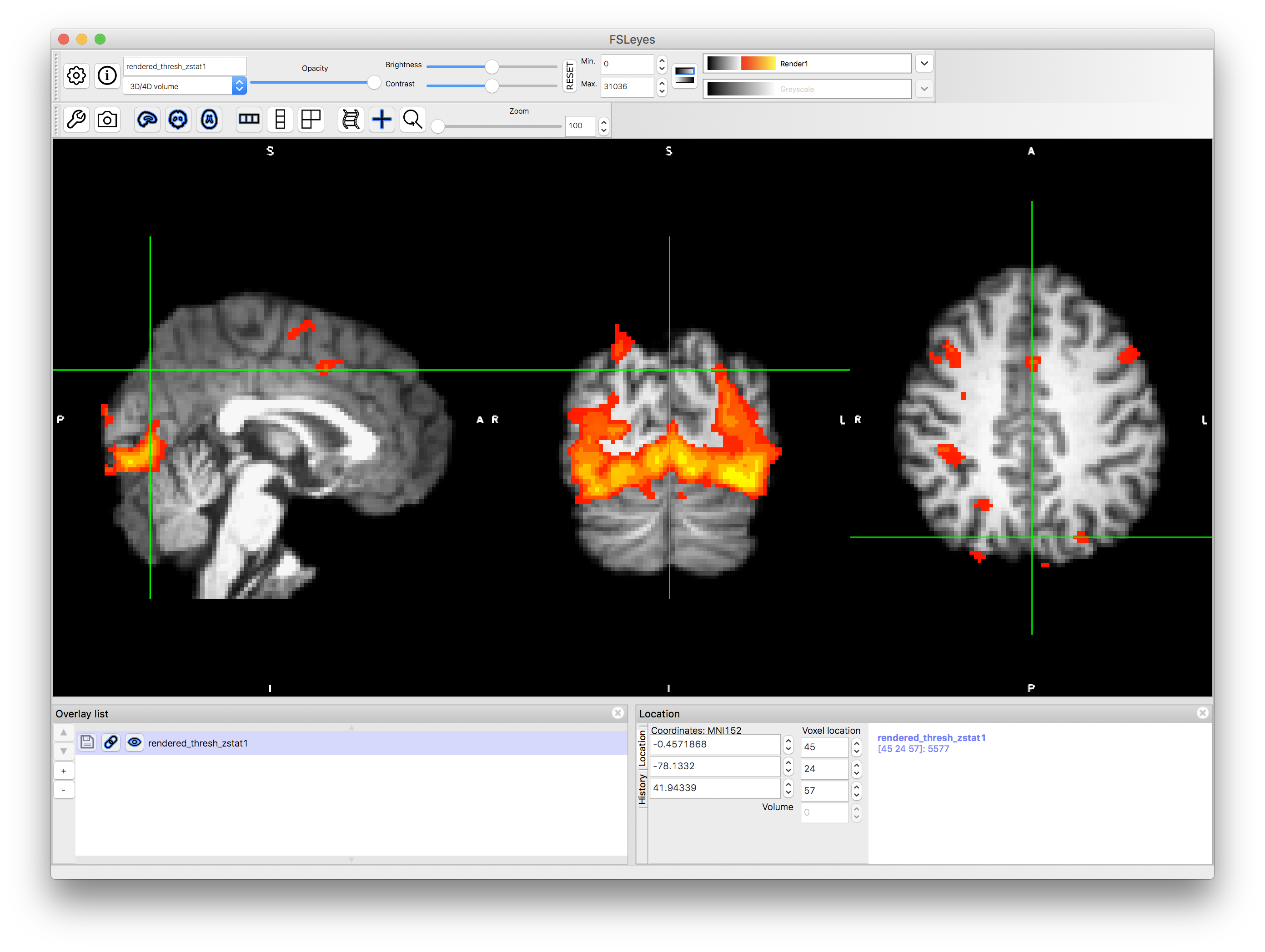 rendered zstat images in fsleyes