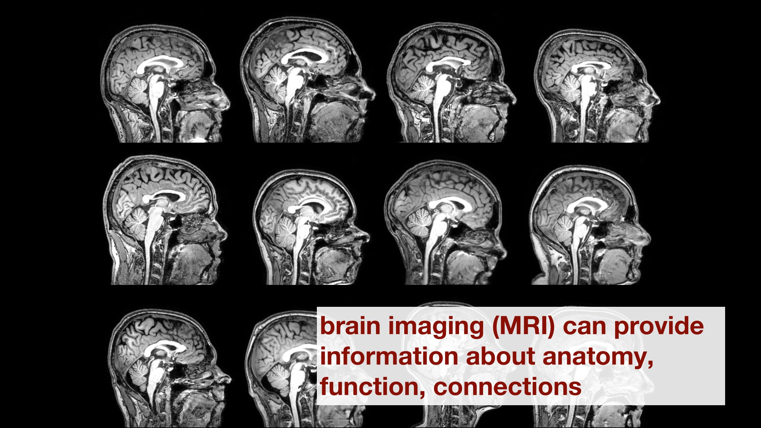 MRI information