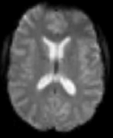 fMRI image