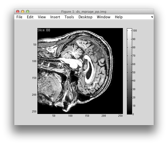 Picture of image viewer